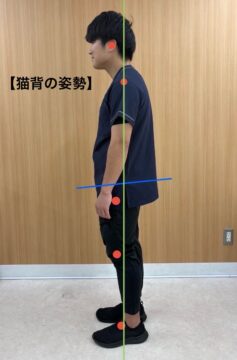 【悪い姿勢】猫背の画像