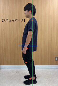 【悪い姿勢】スウェイバックの画像