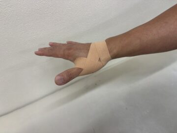 【親指の痛み】母指CM関節症のテーピングの画像